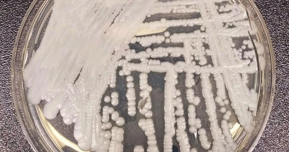 Грибок Candida auris виявив унікальний механізм виживання на шкірі людини